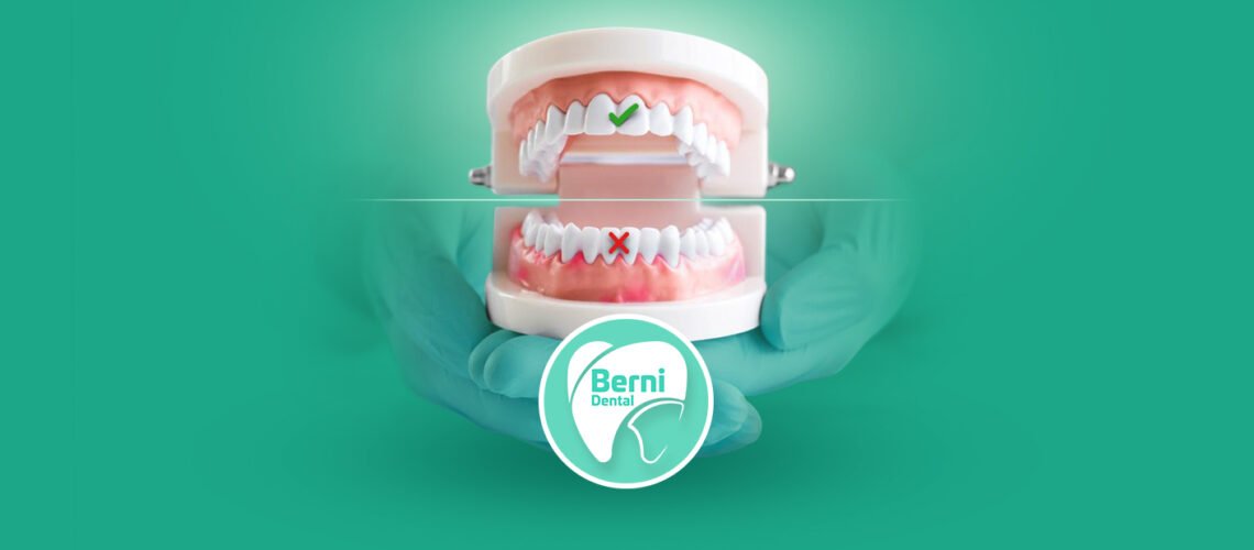 BERNI DENTAL